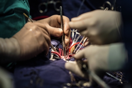 Тюменские кардиохирурги впервые на Урале провели операцию по расширению аортального клапана у новорожденного